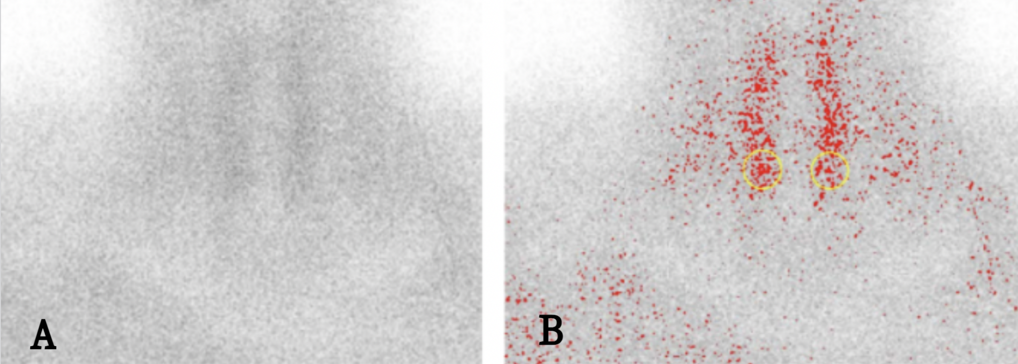 Figure 2 — Negative finding: delayed phase scan with measurement regions marked